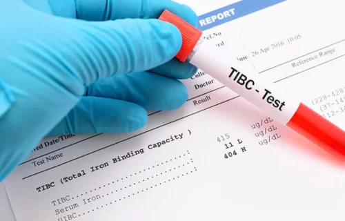 آزمایش TIBC چیست؟ + تشخیص کم خونی